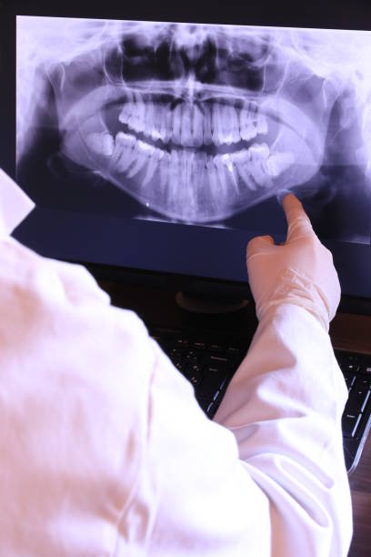 Best Emergency Wisdom Teeth Removal in Tysons, VA