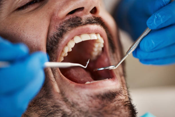Best Same-Day Emergency Dentist in Tysons, VA