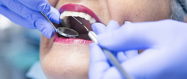 Best Emergency Tooth Extraction in Tysons, VA